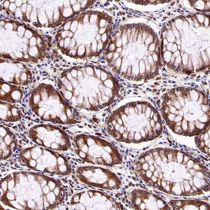 Dynamin 2 Recombinant Rabbit mAb (S-1751-209)