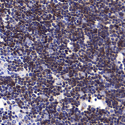 CD1c Recombinant Rabbit mAb (S-5242)