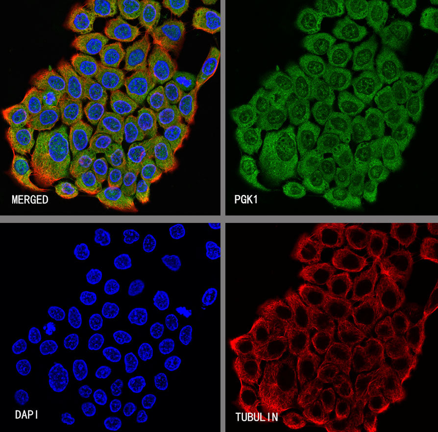 PGK1 Mouse mAb