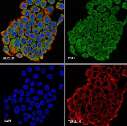 PGK1 Mouse mAb