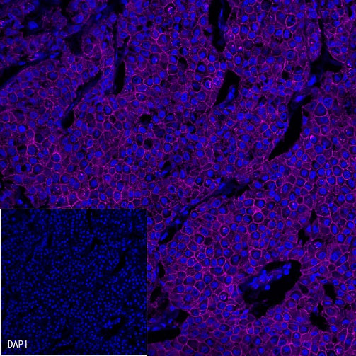 β-Catenin Recombinant Rabbit mAb (Cy5 Conjugate) (S-336-23)