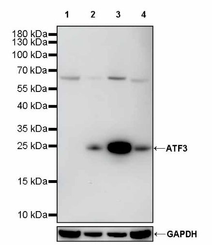 ATF3 Recombinant Rabbit mAb (SDT-4100)