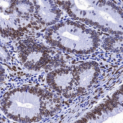 Lamin A Recombinant Rabbit mAb (S-1503-44)