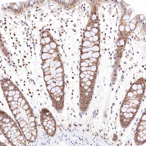 PSME1 Recombinant Rabbit mAb (S-732-14)
