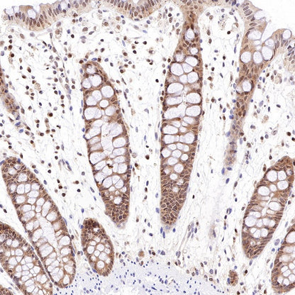 PSME1 Recombinant Rabbit mAb (S-732-14)