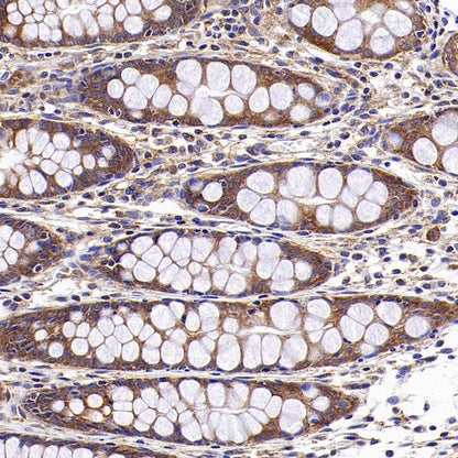 DRP1 Recombinant Rabbit mAb (S-1927-27)