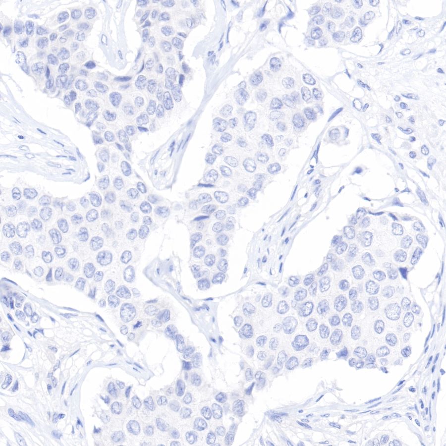 CDX2 Recombinant Rabbit mAb (SDT-134-76)