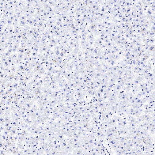 Neurofilament L Recombinant Rabbit mAb (S-635-214)