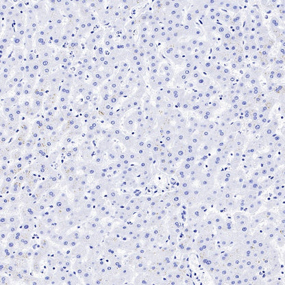Neurofilament L Recombinant Rabbit mAb (S-635-214)