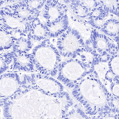 Androgen Receptor Recombinant Rabbit mAb (SDT-R157)