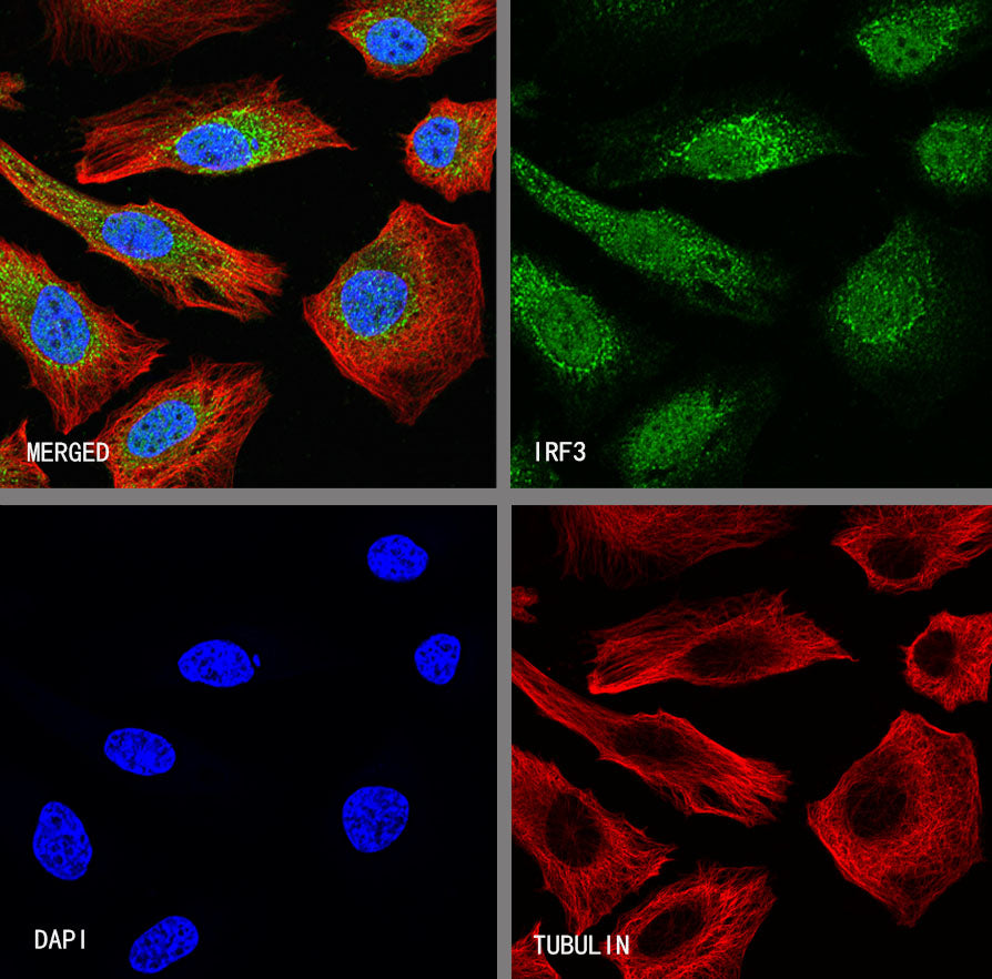 IRF3 Recombinant Rabbit mAb (S-4395)