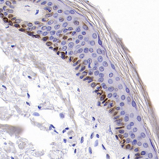 Integrin beta 6 Recombinant Rabbit mAb (SDT-1445-78)