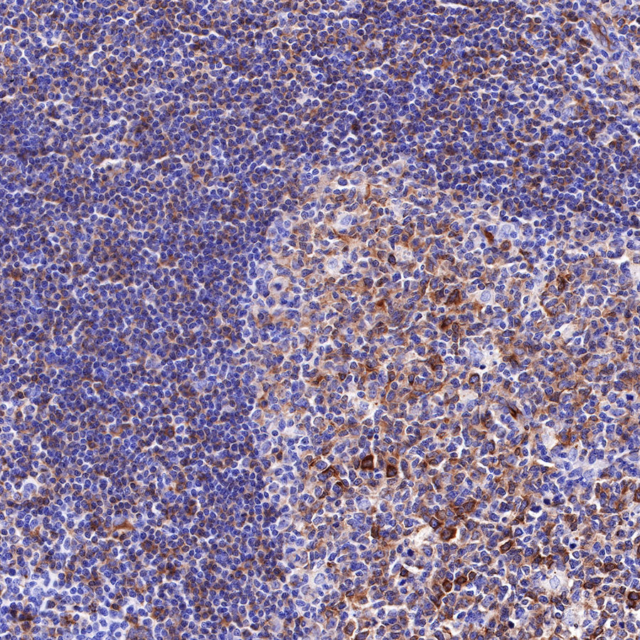 Beta III tubulin Recombinant Rabbit mAb (SDT-251-28)