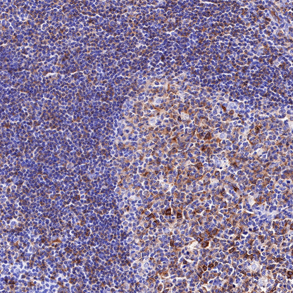 Beta III tubulin Recombinant Rabbit mAb (SDT-251-28)