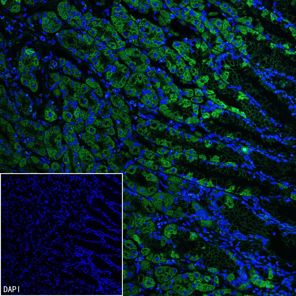 TFAM Recombinant Rabbit mAb