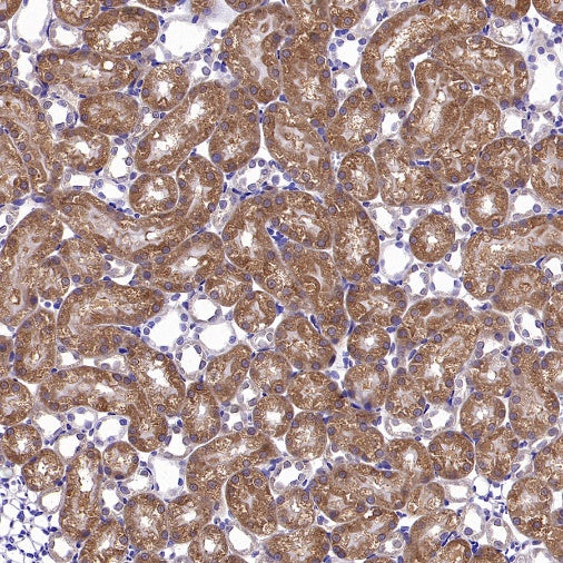 Phospho-eIF4E (Ser209) Recombinant Rabbit mAb (S-2652-195)