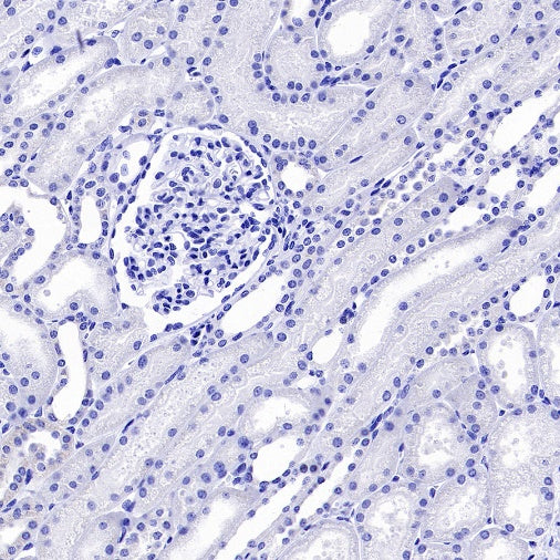 LIN28B Recombinant Rabbit mAb (S-2360-117)