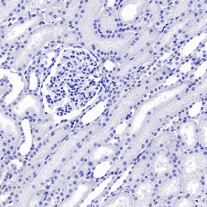 LIN28B Recombinant Rabbit mAb (S-2360-117)