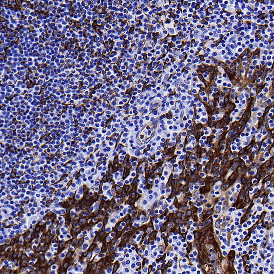 PTGES Recombinant Rabbit mAb (S-4351-18)