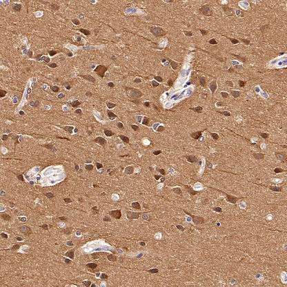 LC3B Recombinant Rabbit mAb (S-1599-142)