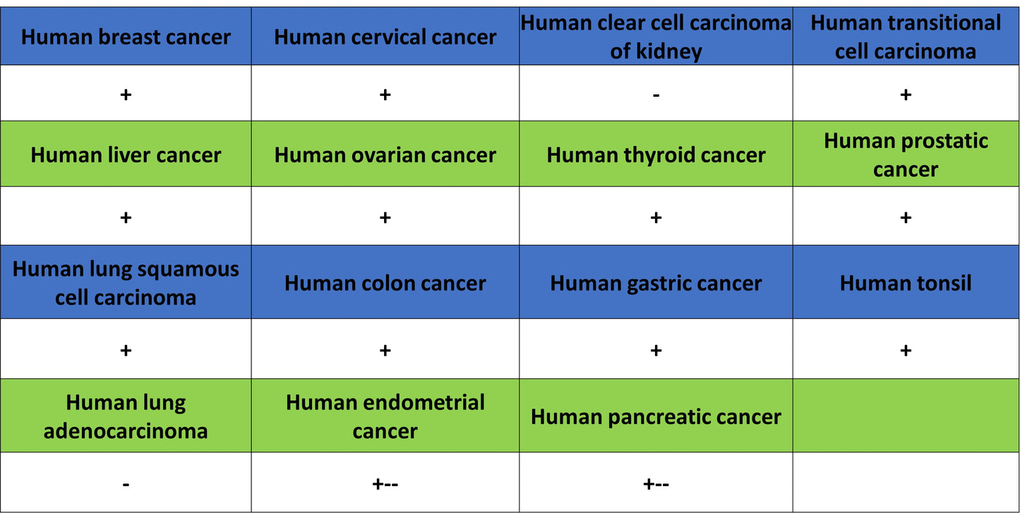 CCDC47 Recombinant Rabbit mAb (S-4158-17)