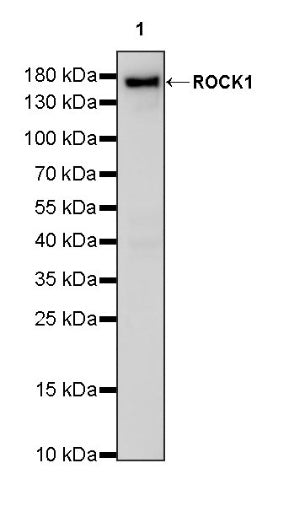 ROCK1 Recombinant Rabbit mAb (S-1304-153)