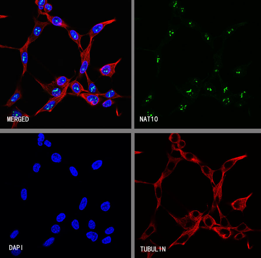 NAT10 Recombinant Rabbit mAb (S-2547-125)