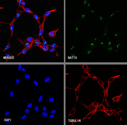NAT10 Recombinant Rabbit mAb (S-2547-125)