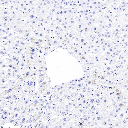 KLK2 Recombinant Rabbit mAb,PBS Only (SDT-4461-80)