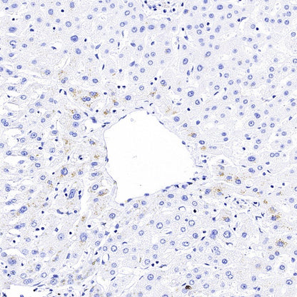 KLK2 Recombinant Rabbit mAb,PBS Only (SDT-4461-80)