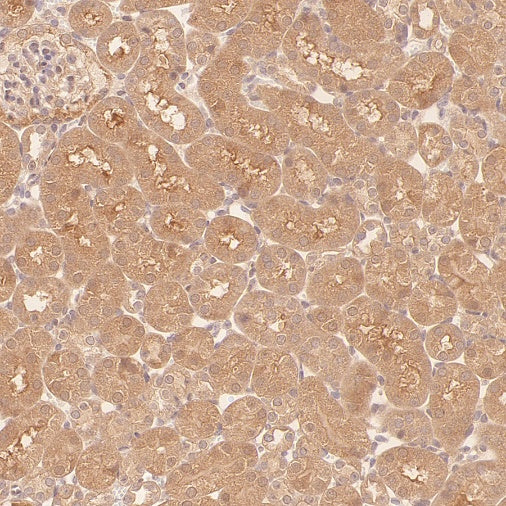 NEK7 Recombinant Rabbit mAb (S-2494-70)