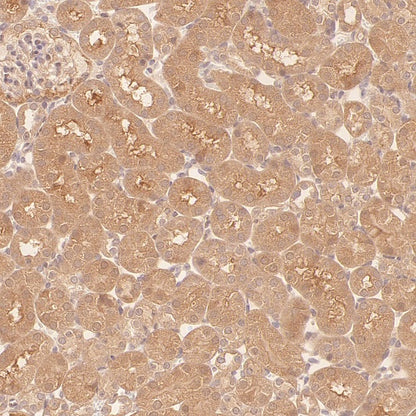 NEK7 Recombinant Rabbit mAb (S-2494-70)