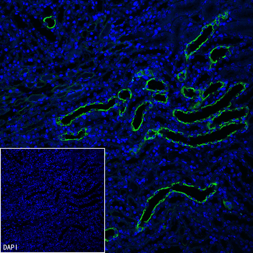 Cytokeratin 7 Recombinant Rabbit mAb (S-5954)