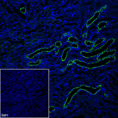 Cytokeratin 7 Recombinant Rabbit mAb (S-5954)