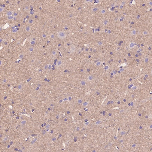 Rac1/2/3 Recombinant Rabbit mAb (S-2720-10)