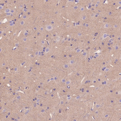 Rac1/2/3 Recombinant Rabbit mAb (S-2720-10)