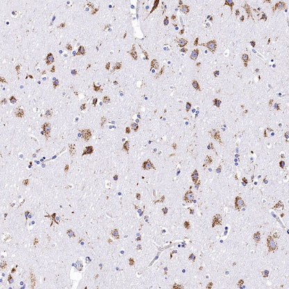 Cathepsin B Recombinant Rabbit mAb (S-1067-7)