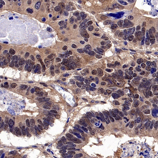 AKT2 Recombinant Rabbit mAb (S-2617-6)