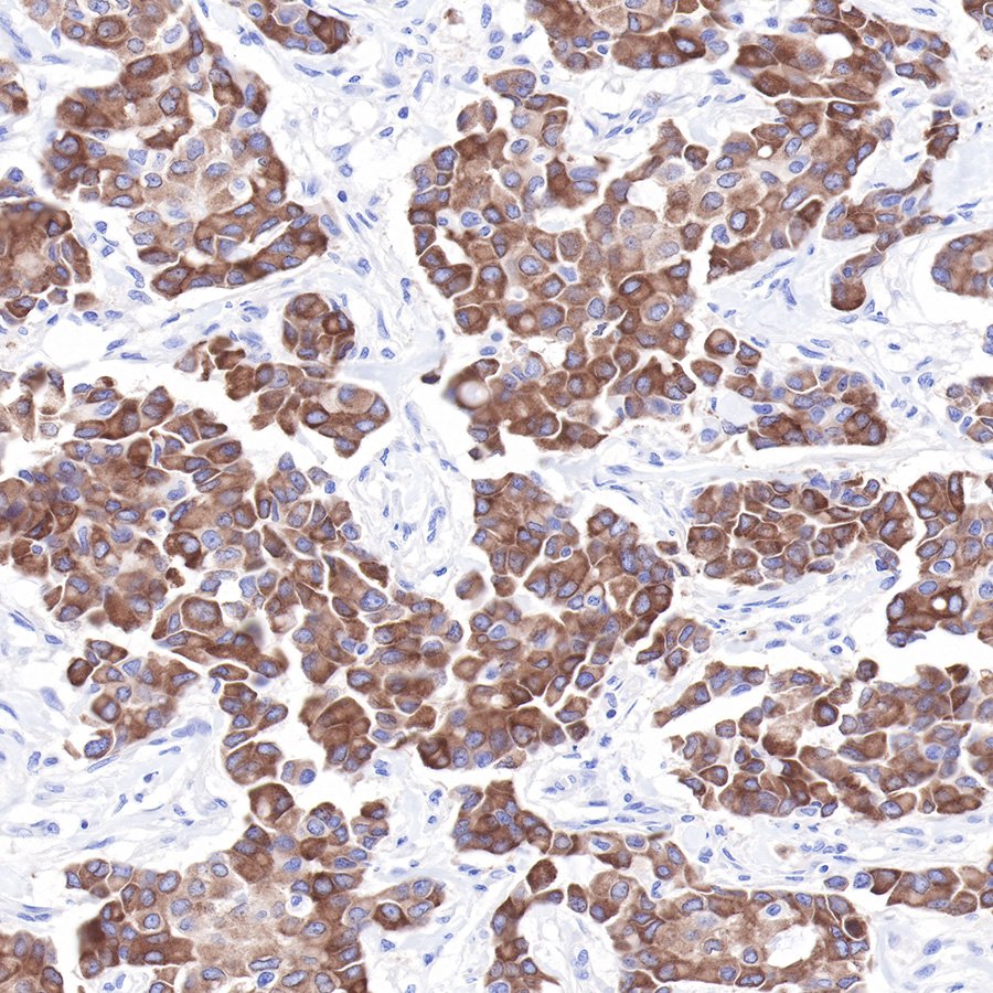 LIV-1/SLC39A6 Recombinant Rabbit mAb (SDT-206-84)