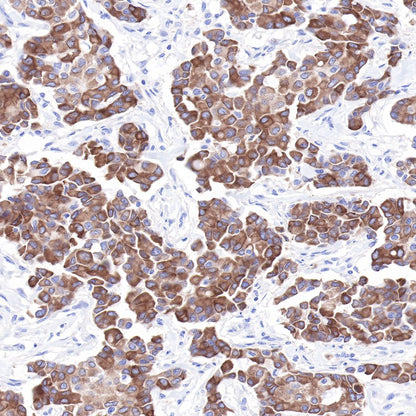 LIV-1/SLC39A6 Recombinant Rabbit mAb (SDT-206-84)
