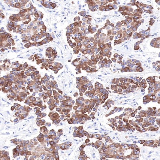 LIV-1/SLC39A6 Recombinant Rabbit mAb (SDT-206-84)