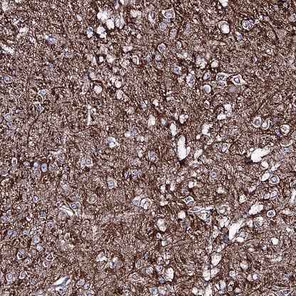 APP Recombinant Rabbit mAb