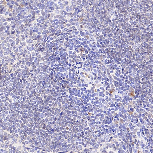 BCL-6 Recombinant Mouse mAb (S-R634)
