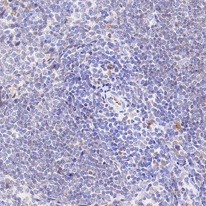 BCL-6 Recombinant Mouse mAb (S-R634)