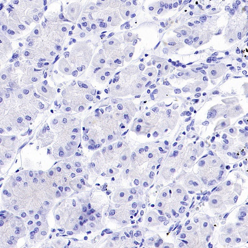 ATF3 Recombinant Rabbit mAb (SDT-4100)
