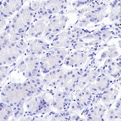 ATF3 Recombinant Rabbit mAb (SDT-4100)