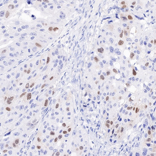 Geminin Recombinant Rabbit mAb (S-427-204)