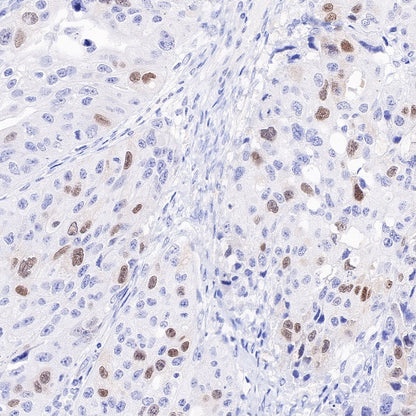 Geminin Recombinant Rabbit mAb (S-427-204)