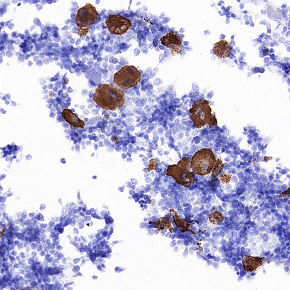 Thrombospondin 1 Recombinant Rabbit mAb (S-4153-22)