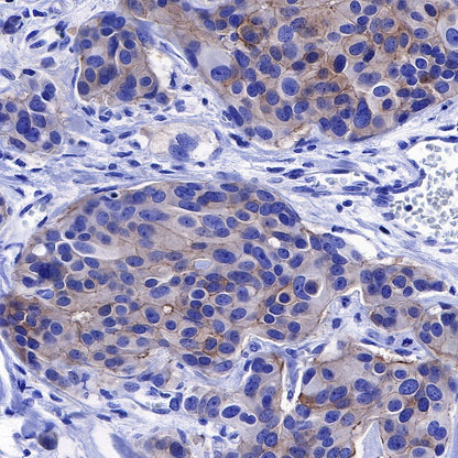 ErbB4 Recombinant Rabbit mAb (S-496-61)